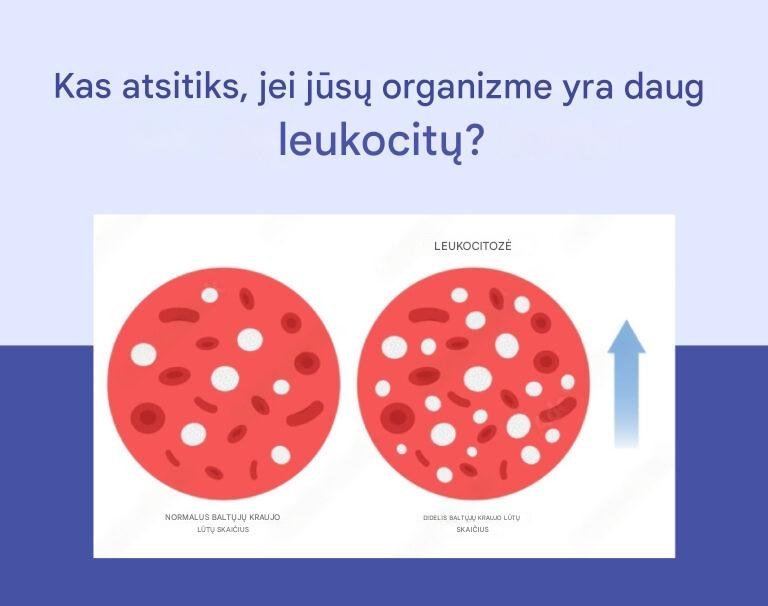 Leukocitoze padideje leukocitai
